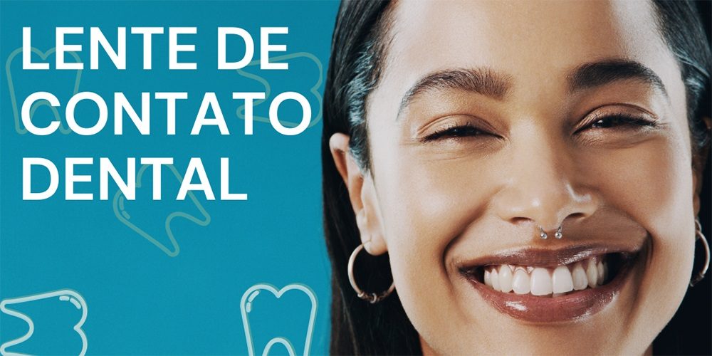 Lentes de contato dental | No que acreditar?