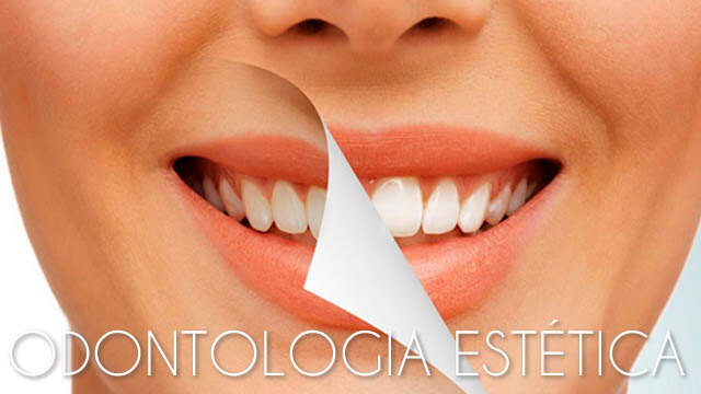 Odontologia Estética 