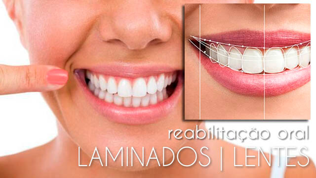 Reabilitação Oral | Laminados | Lentes